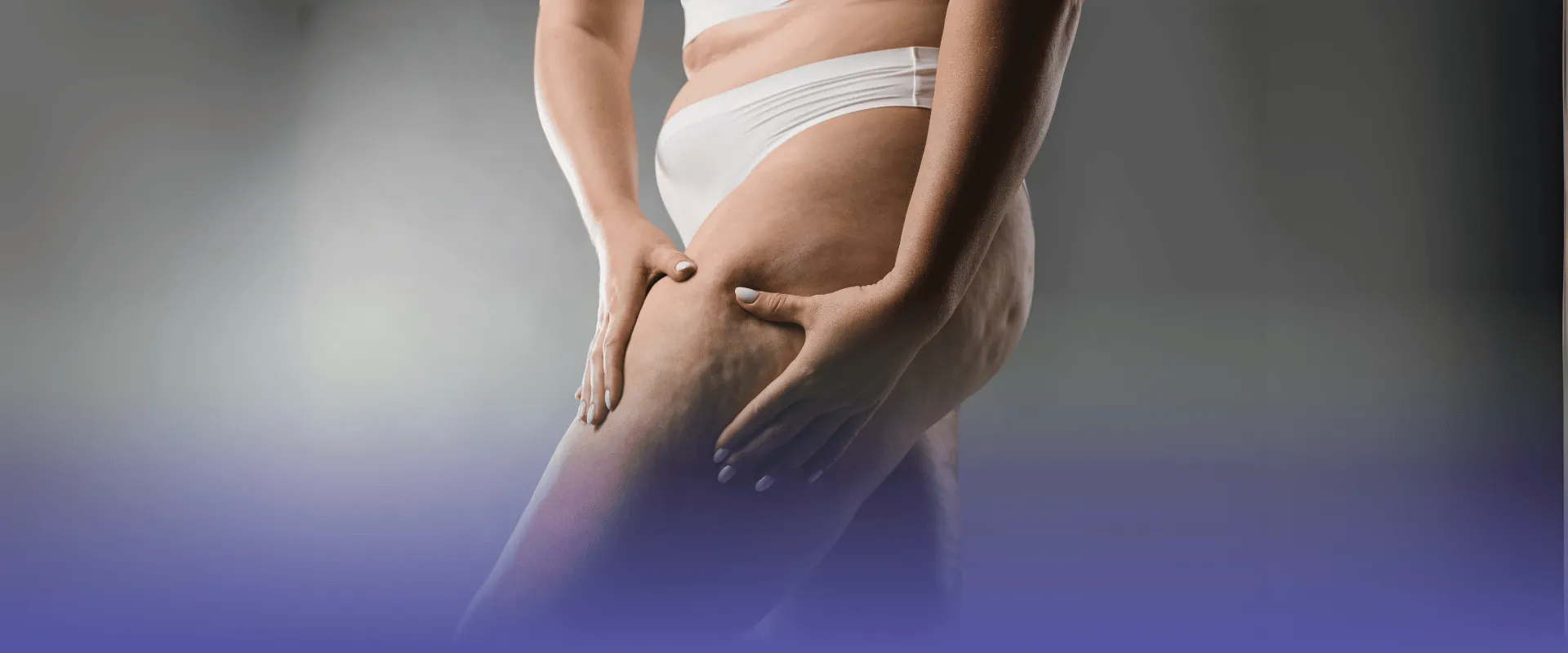 Saiba tudo sobre o lipedema: o que é, sintomas e como tratar